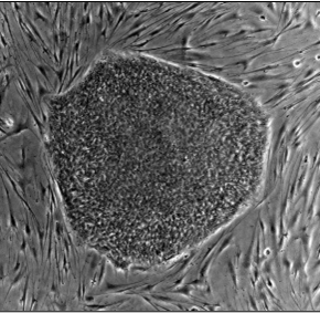 Cellule derivate da cellule staminali pluripotenti indotte: la prima nell’uomo