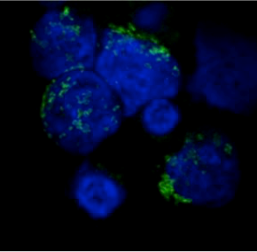 Blocco farmacologico del trasportatore del glucosio Glut1 per controllare l’autoimmunità: nuovo studio supportato da JDRF