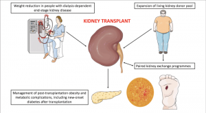 Potential-roles-of-metabolic-surgery-in-facilitating-access-to-kidney-transplantation-2